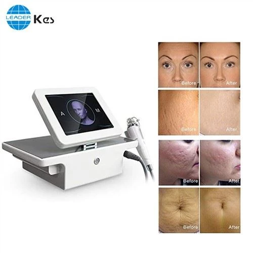 Rf Microneedle Rf Microneedle Machine Salon Naudokite nešiojamą frakcinę Rf veido pakėlimo mikroadatą Equipo